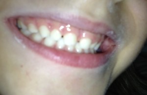 Cooter and his loose tooth smile--he's THRILLED.  I'm not ready.