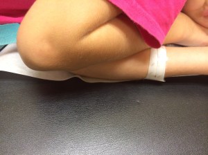 They arm "banded" my sweet girl and sent us back very quickly tonight.  She was so worn out, she curled up on the table and went to sleep.  Bless her.  